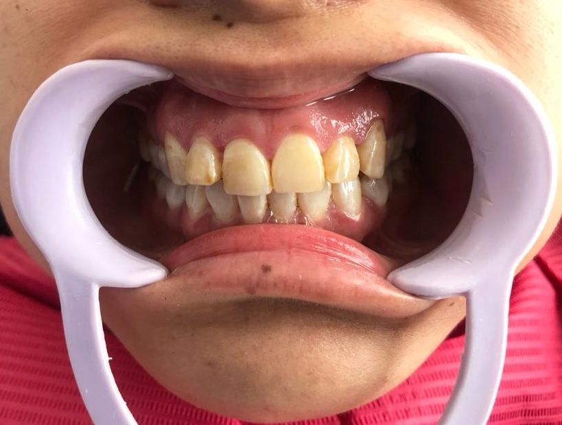 Martha Grissel Alcantar Camacho-5