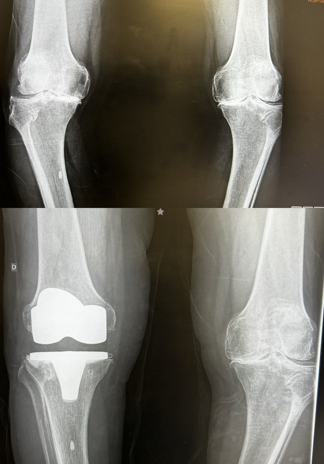 Diego Armando Contreras Rojas-20