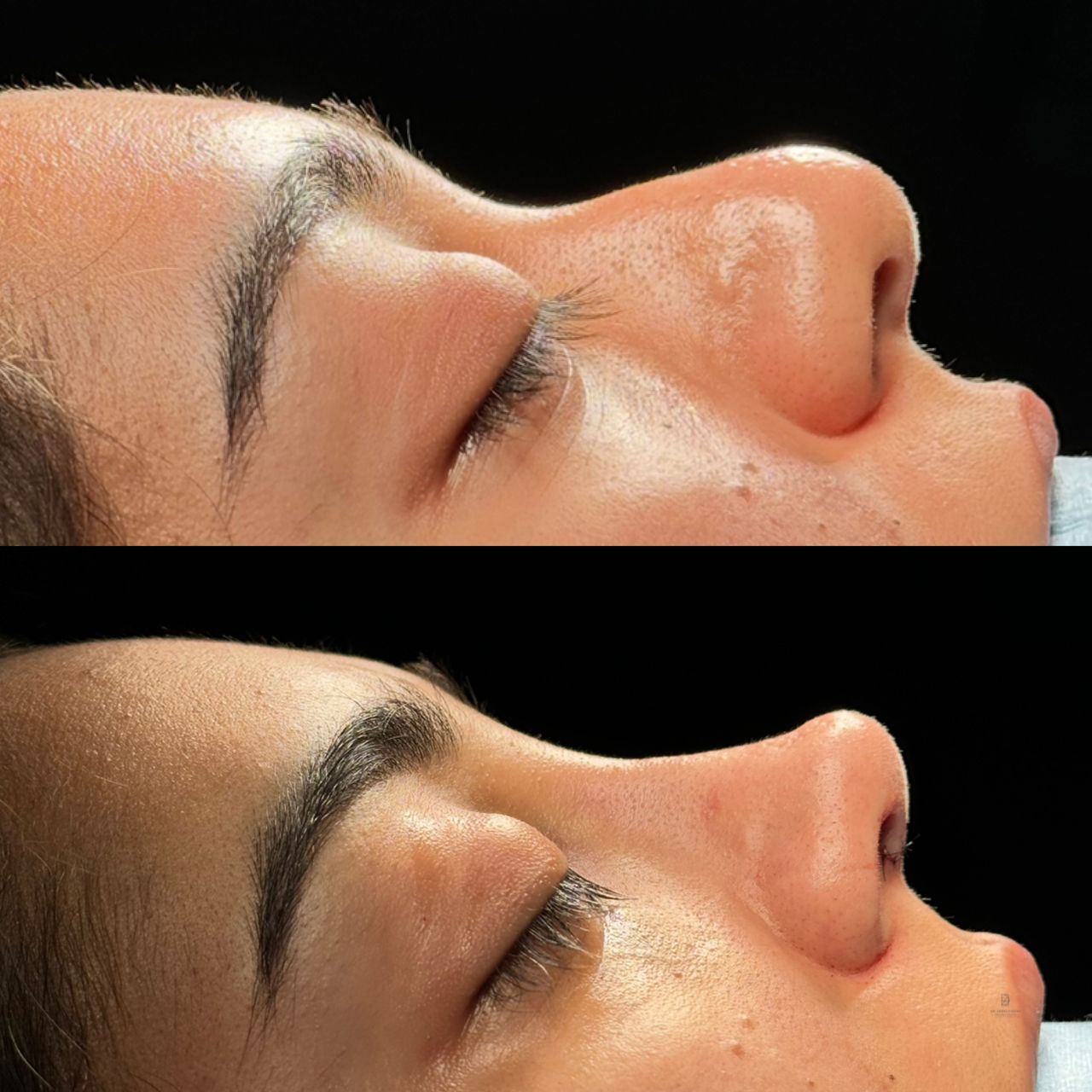 Angel Castro Urquizo-210