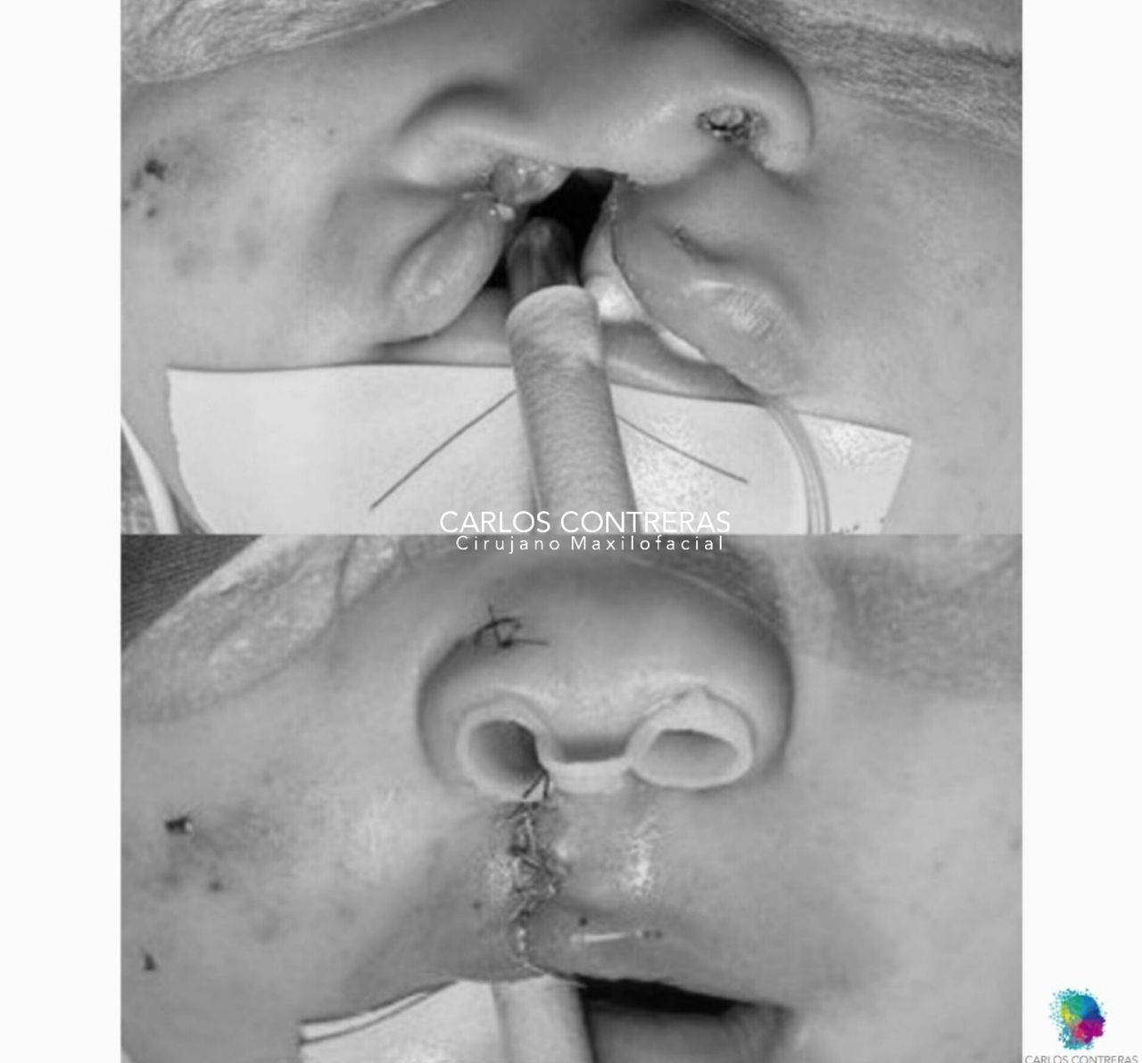 Carlos Ernesto Contreras Castellanos-38