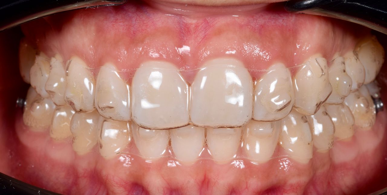 Adair Natanael Alvarez Castañeda-7