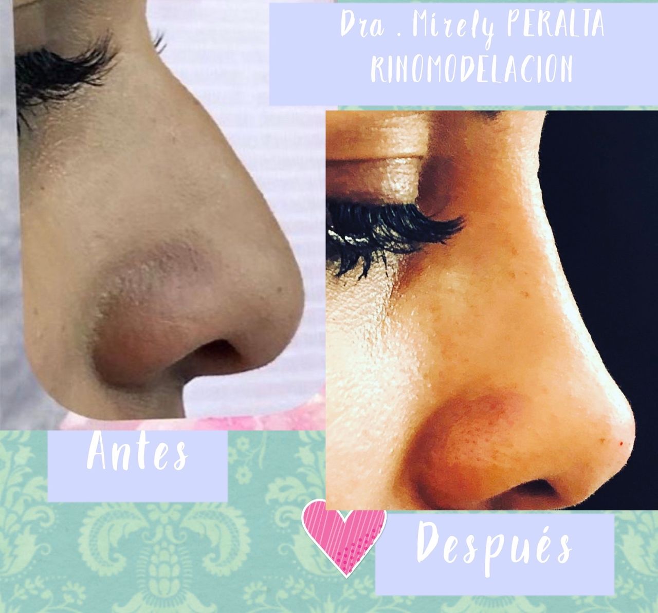 Mirely Peralta Rodríguez-6