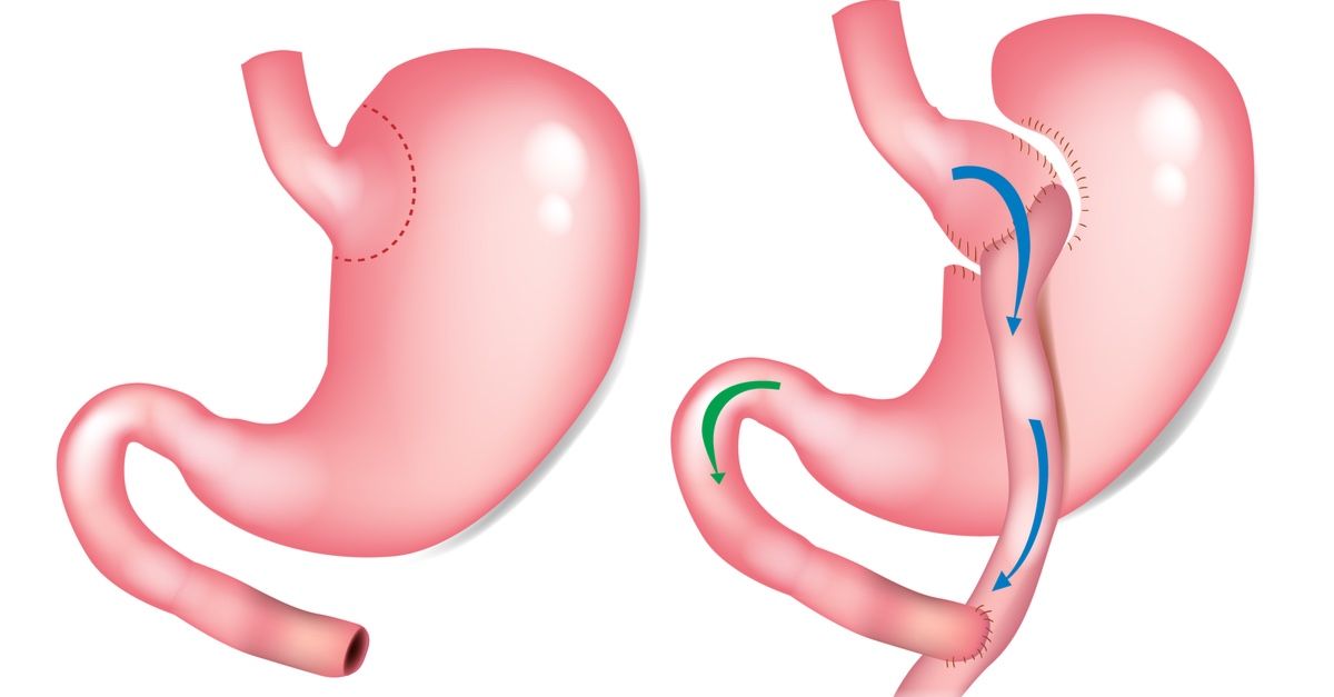 Rafael Alejandro García Serrano-2