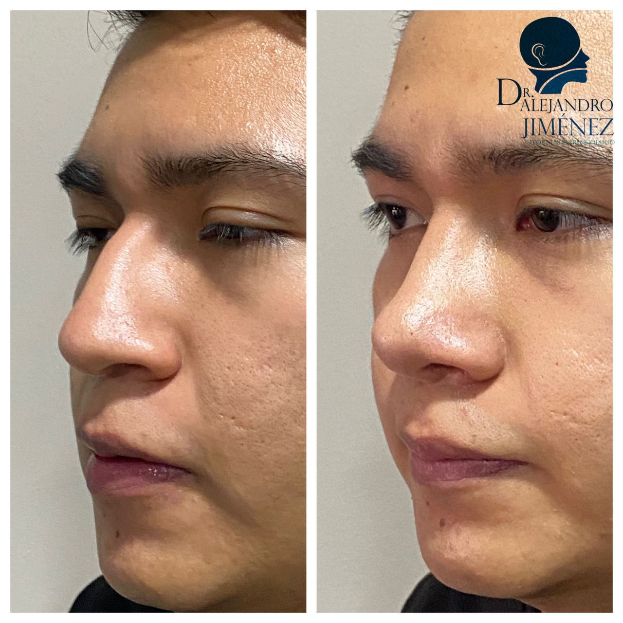 Alejandro Jimenez Garcia-32