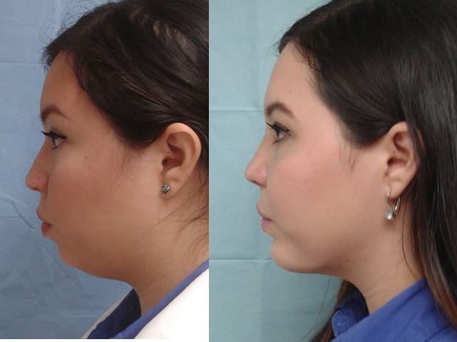 Marisol Ceja Zepeda-45