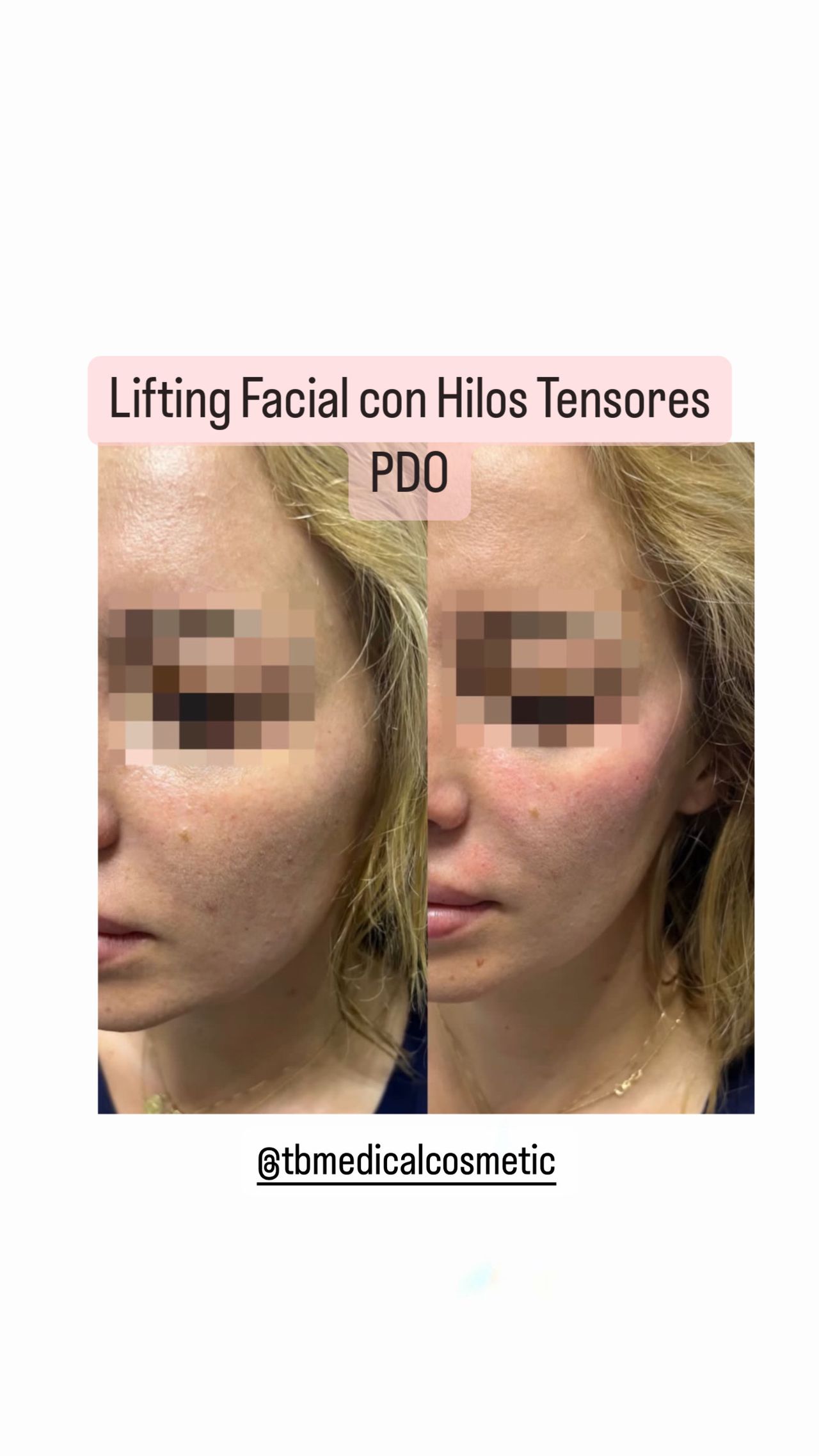 Tamara Milagros Burgos Fonseca-7