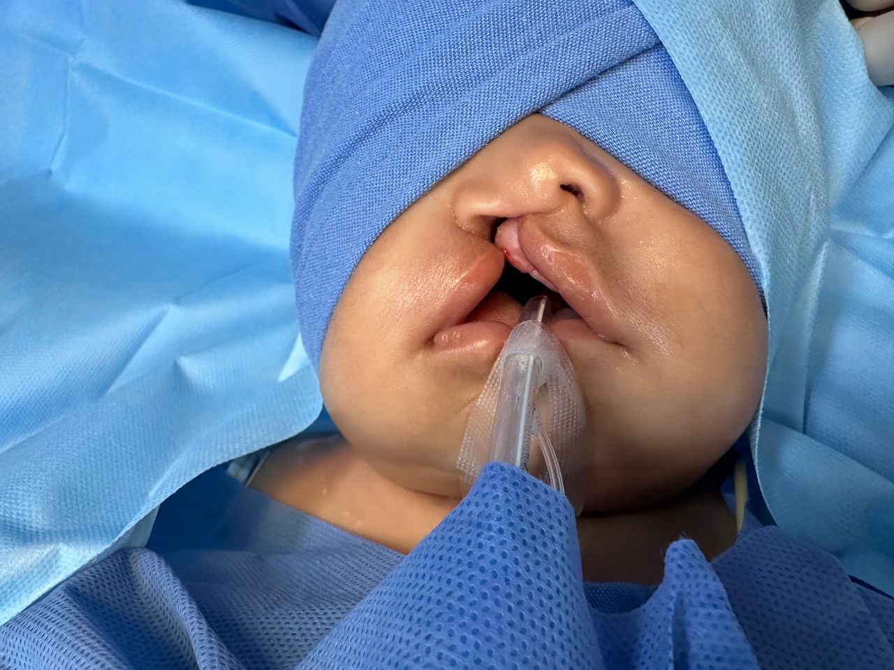 Erendalhi Rocha Mesta-3