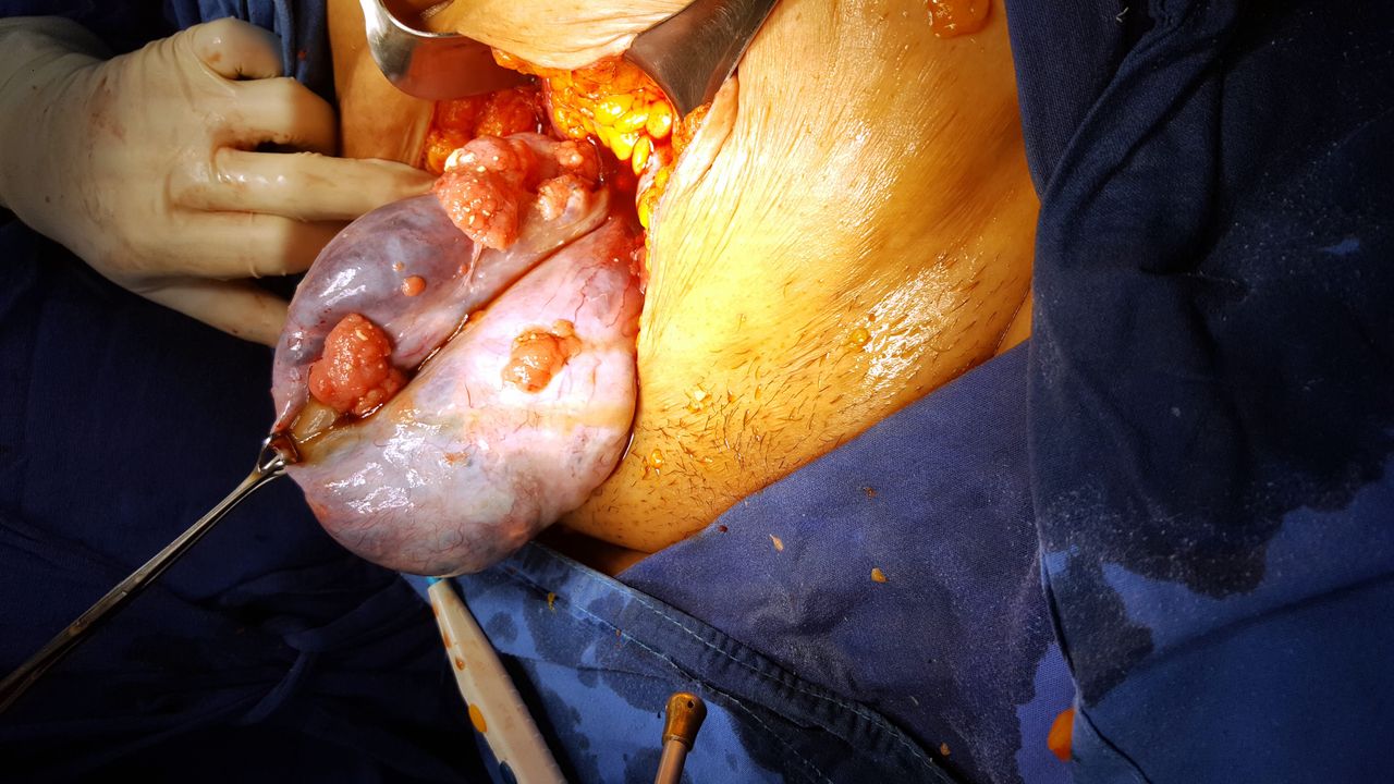 Ángel Millán Juárez-38