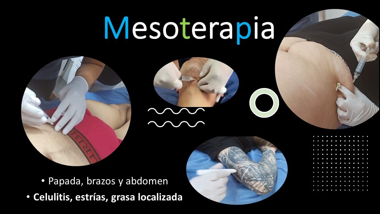 José Luis Muñoz Chapul-11