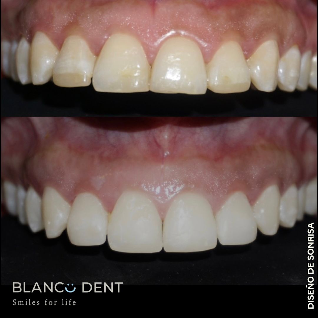 Karen Monserrat Gomez Reyes-26