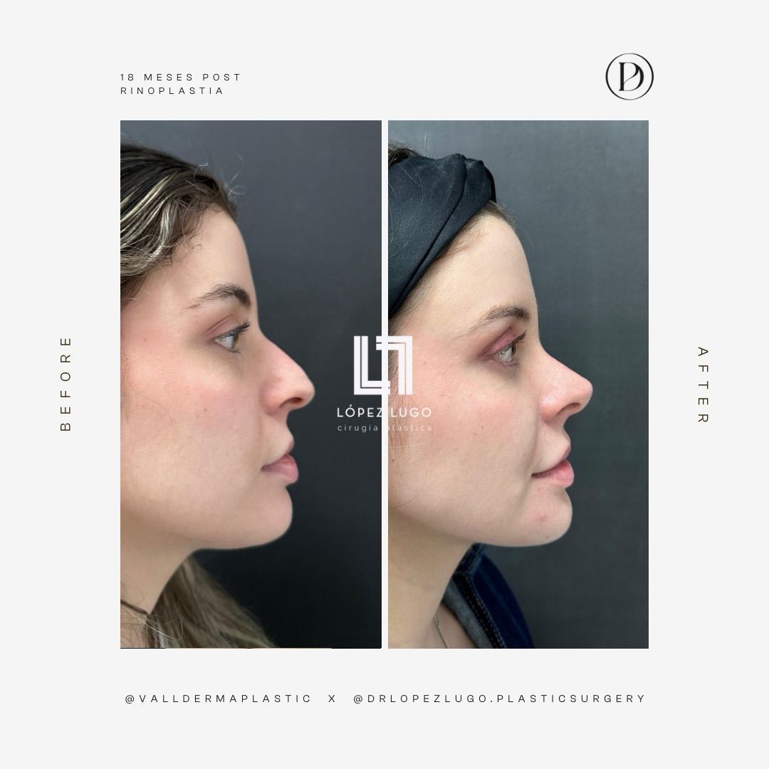 Omar Federico López Lugo-24