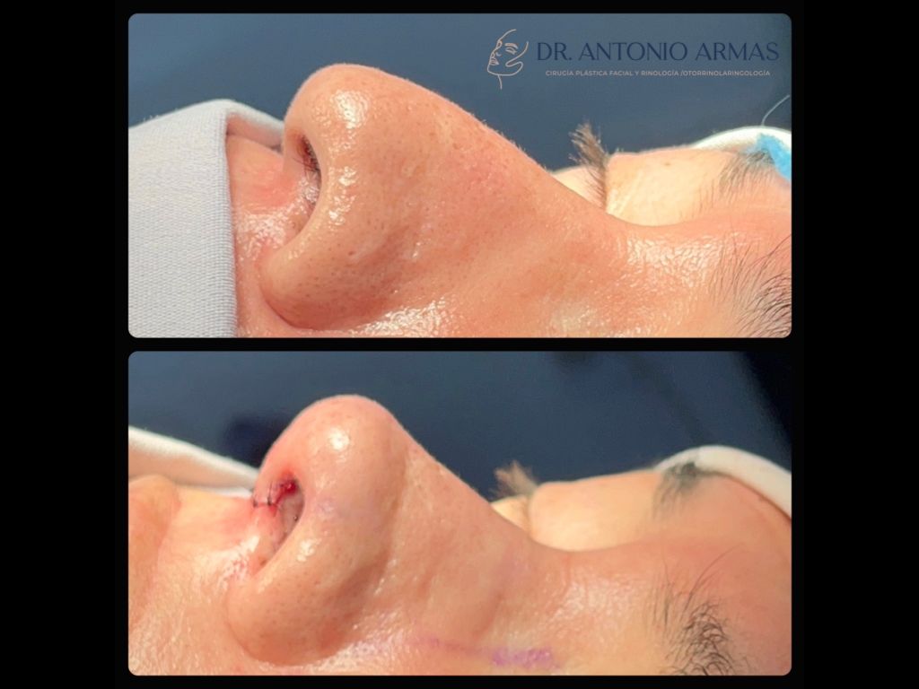 Juan Antonio González Armas-8