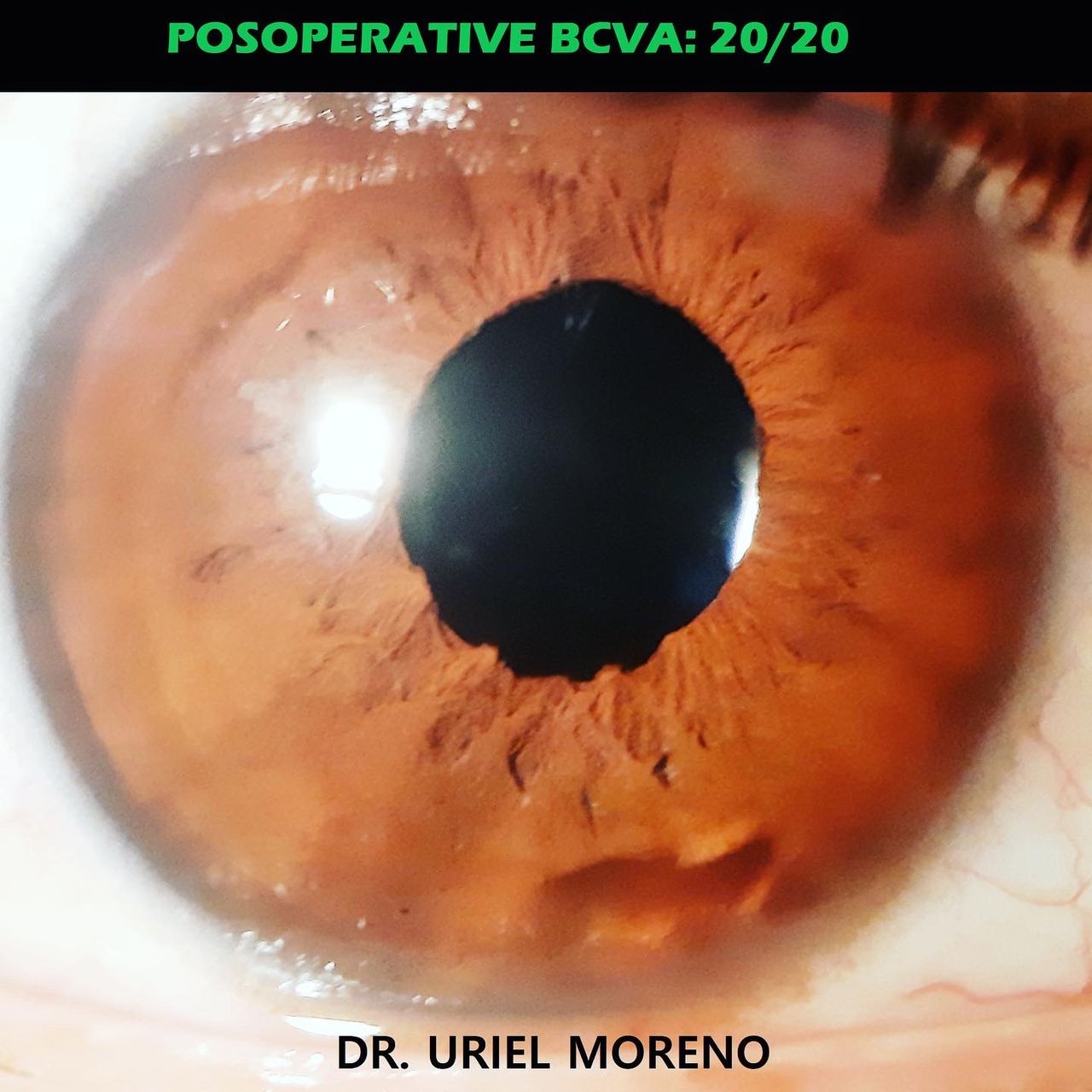 Uriel Moreno Páramo-6