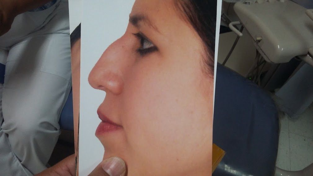 Juan Carlos Pérez Cancino-0