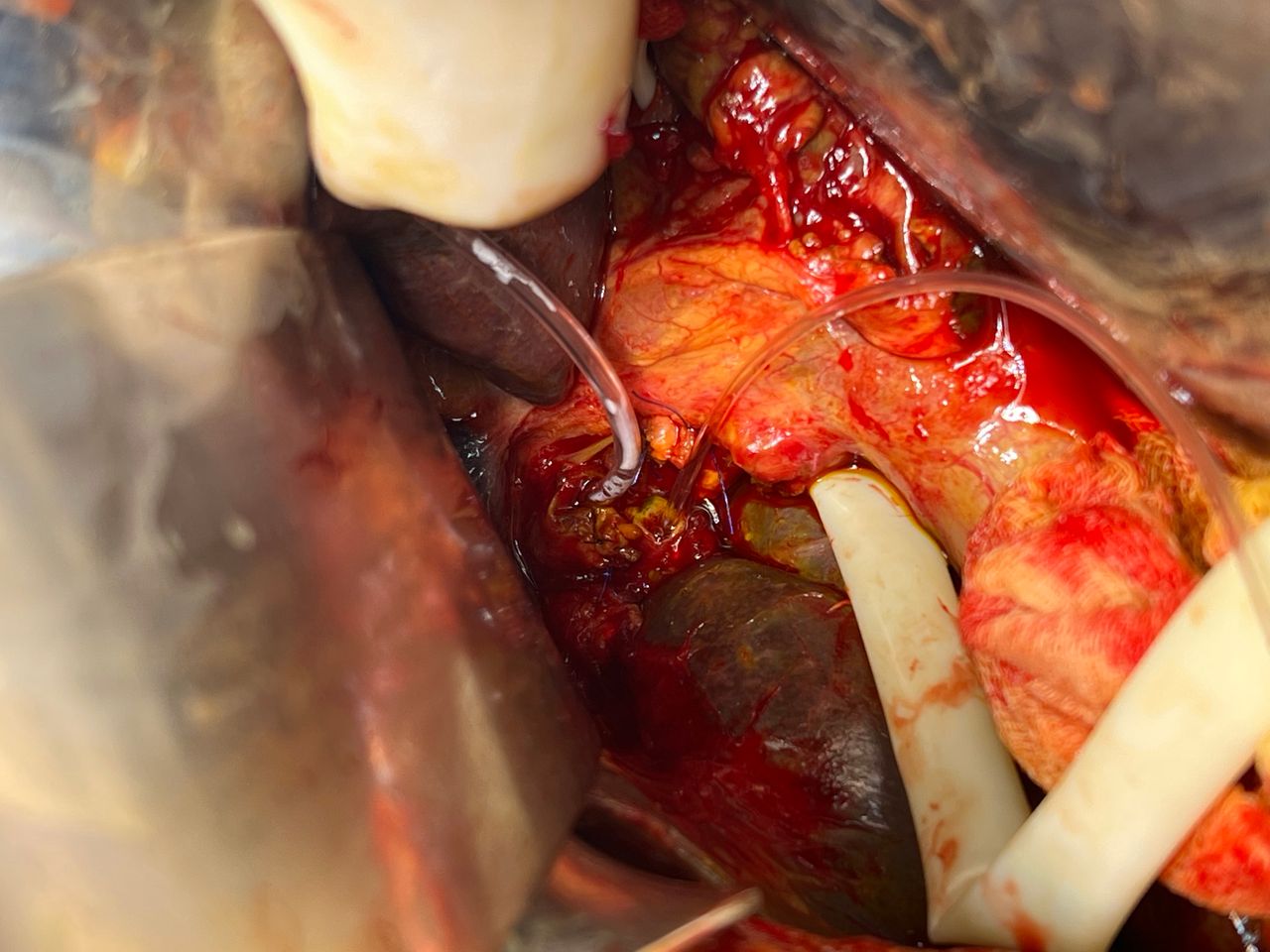 Mateo Ponciano Guerrero-26