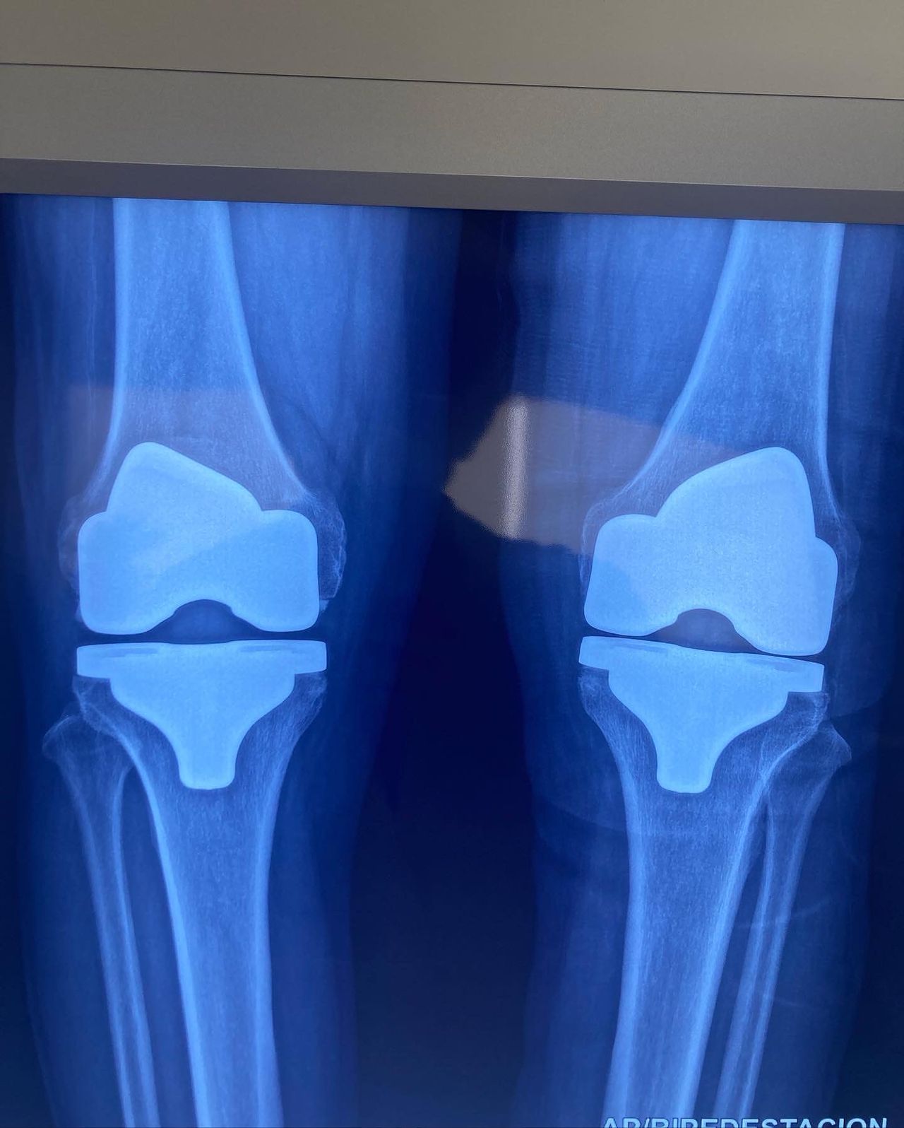 Giovanny Santander Becerra-41