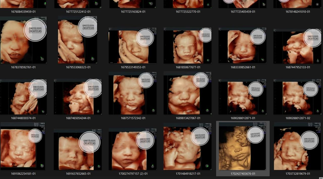 Porfirio Barrera Mata-5