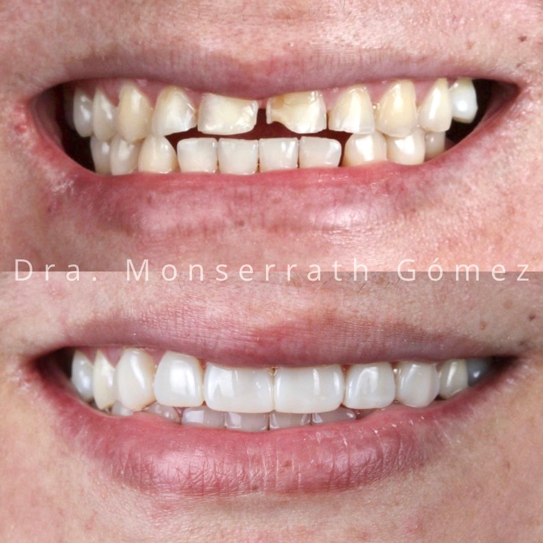 Monserrath Gomez Mendez-5