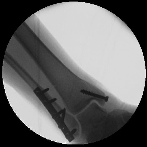 Rafael Adolfo Ferreyra Martinez-17