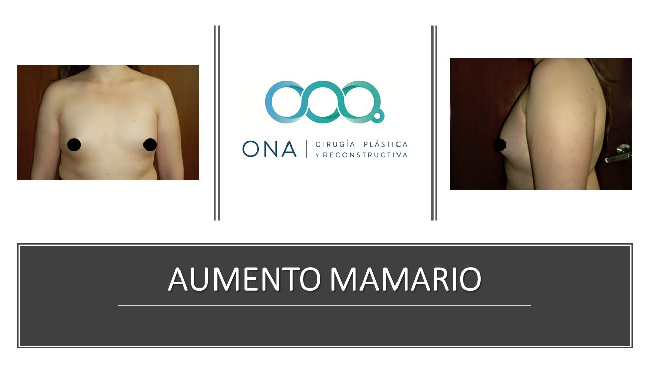 José Luis Segura Castillo-3