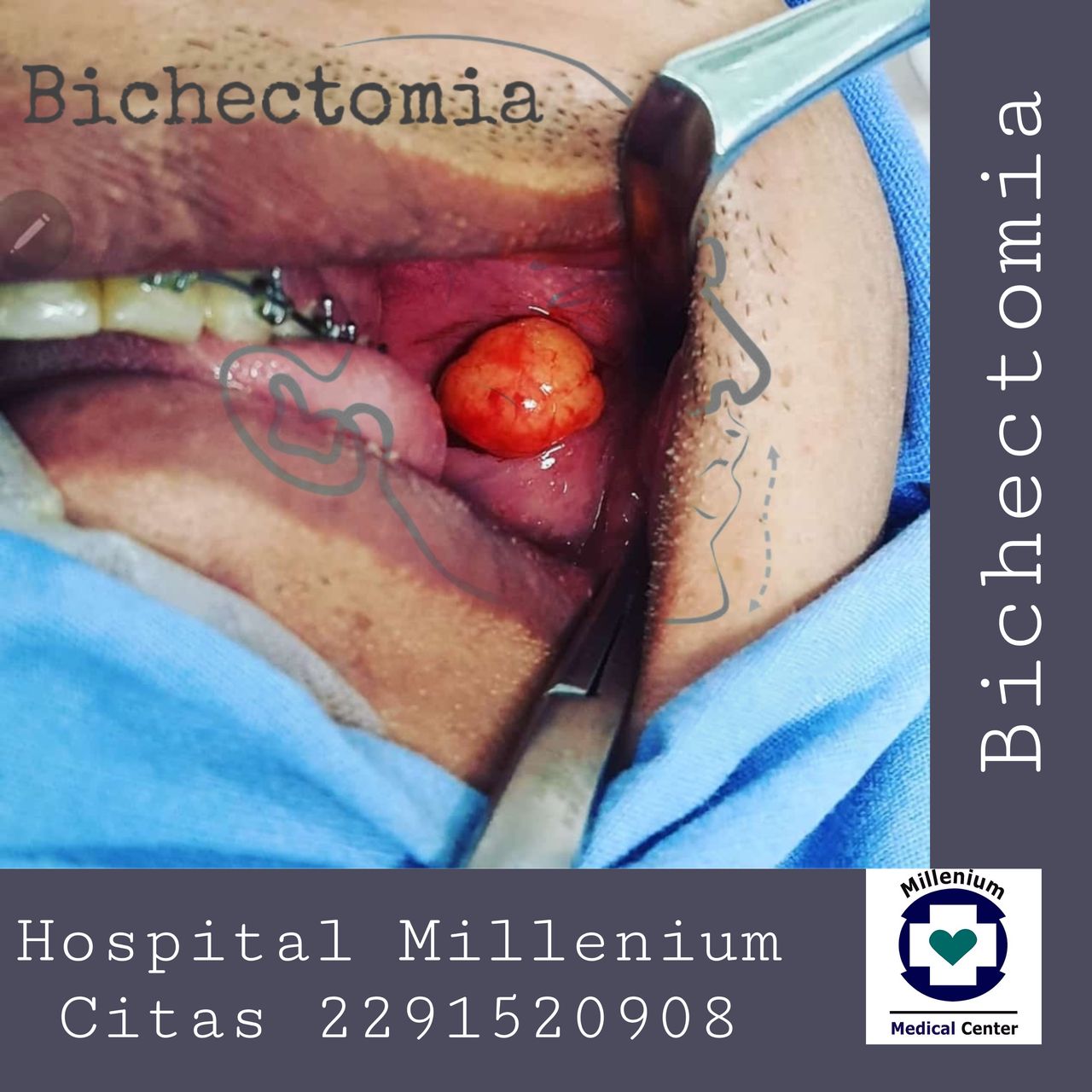 Javier Escobedo Lara-10