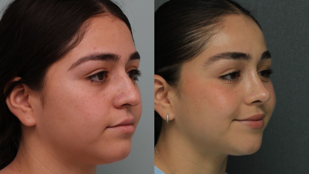 Angel Castro Urquizo-15