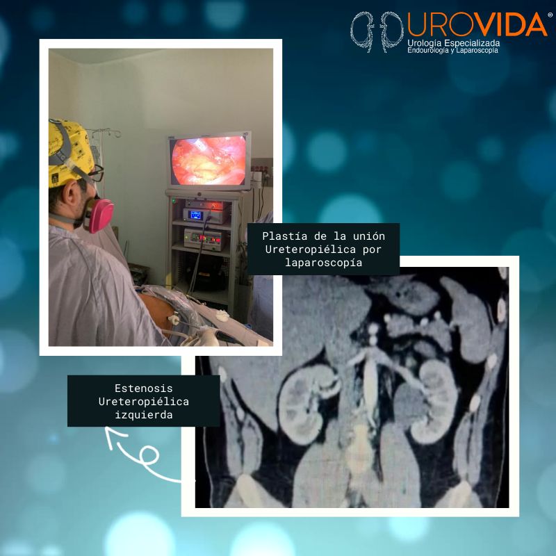 Eddy Gabriel Muñoz Lumbreras-8