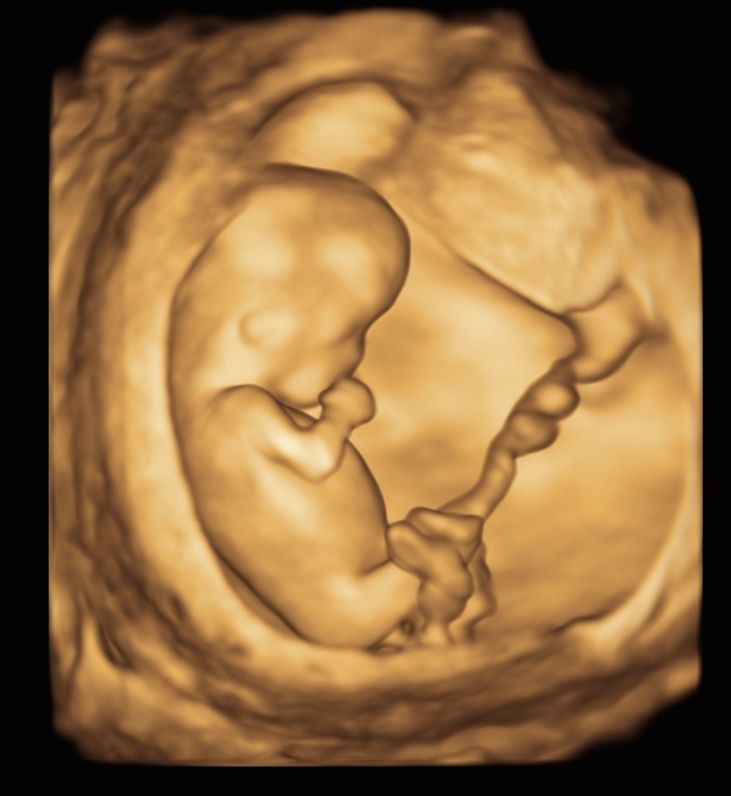 Cesar Octavio Mercado Sahagun-7