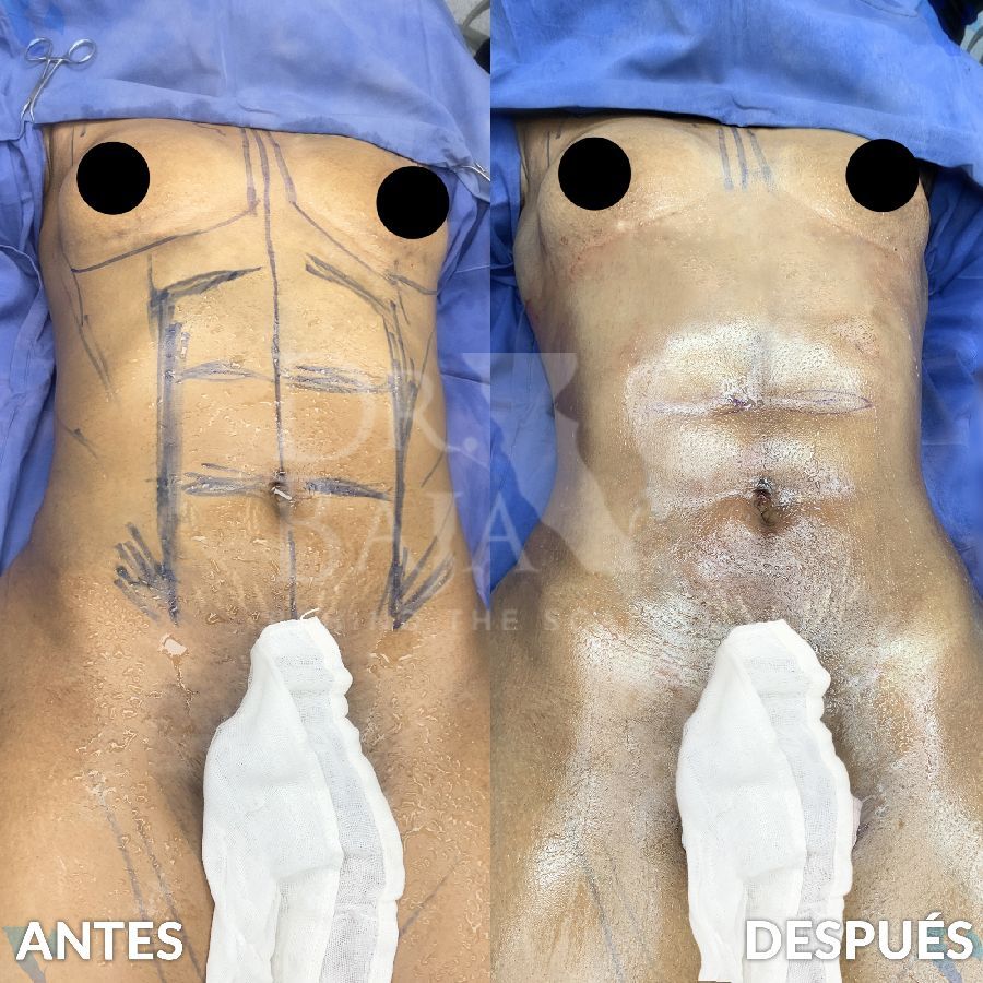 Renato Rodríguez Hirales-3