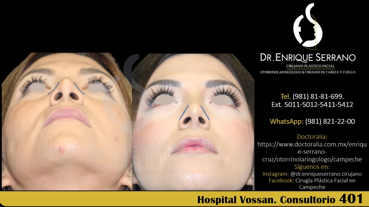 Enrique Serrano Cruz-81