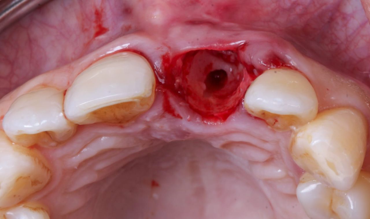 Hugo Enrique Aguilar Lamas-13