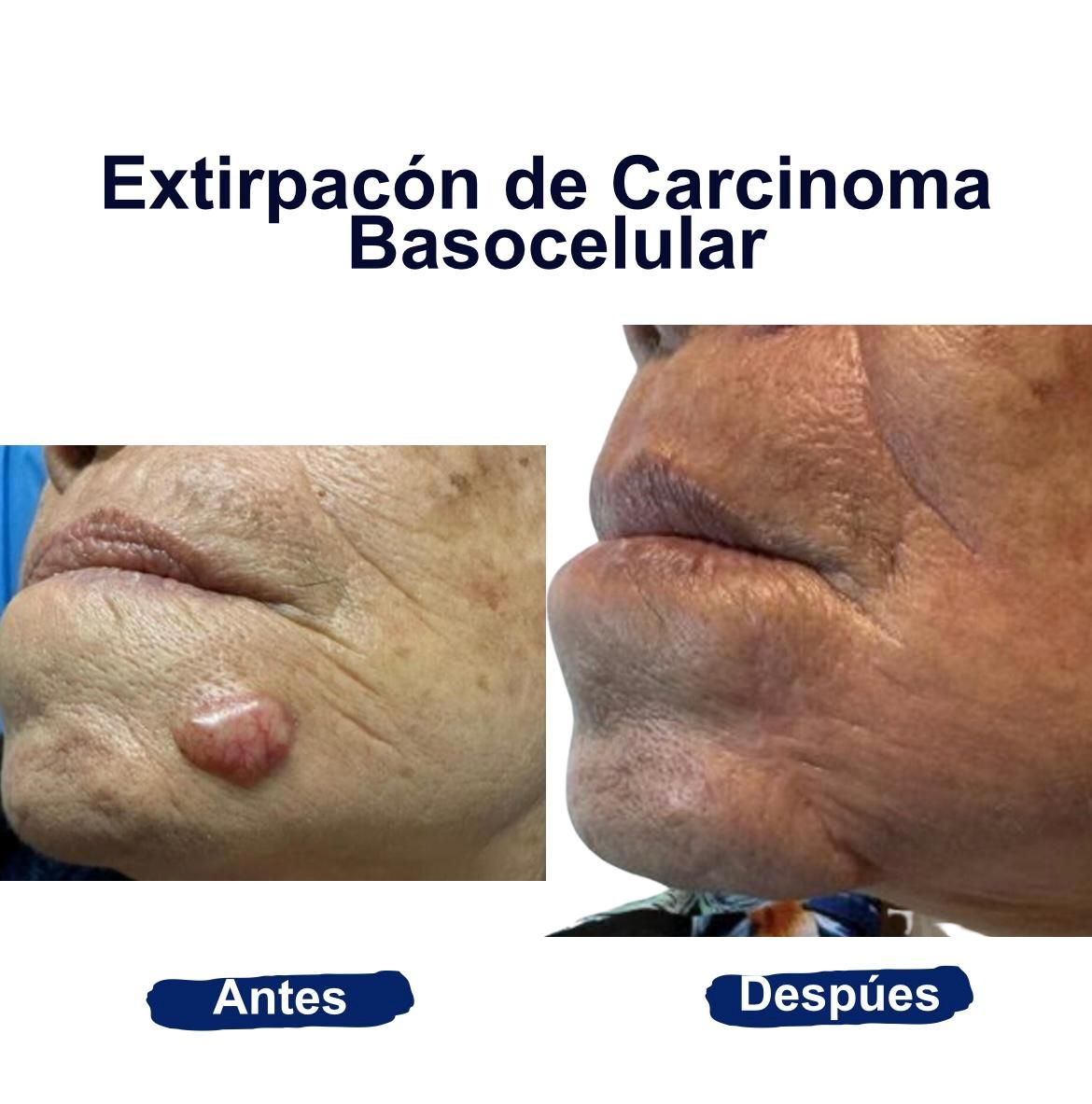 Itzel Anayn Flores Reyes-39