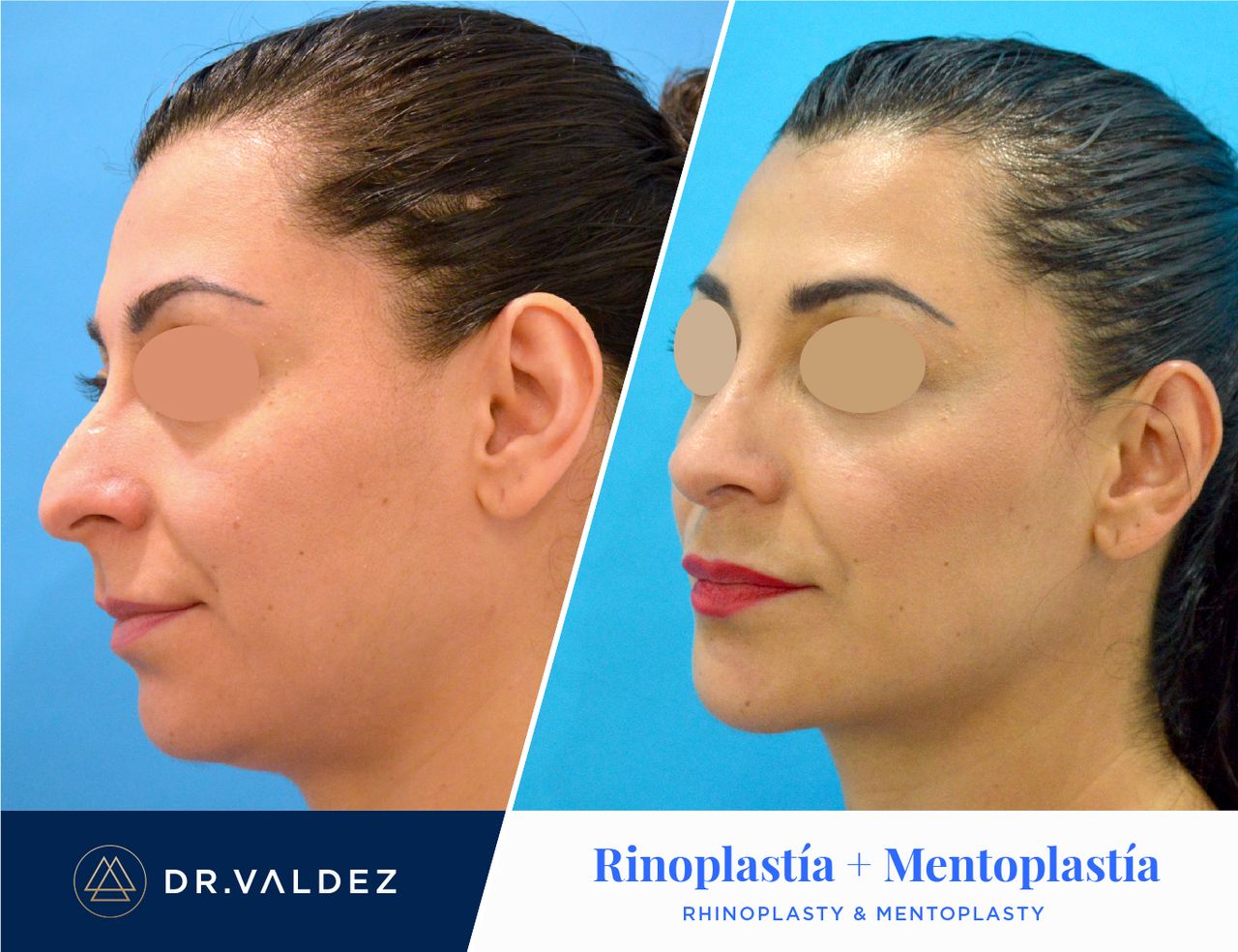 Pedro Arturo Valdez Gomez-7