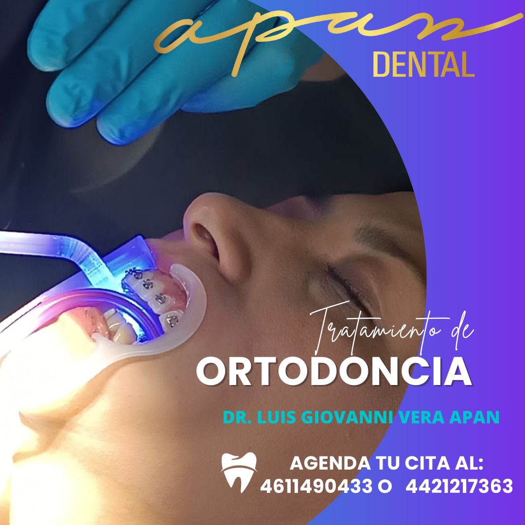 Zuleica Vera Apan-44