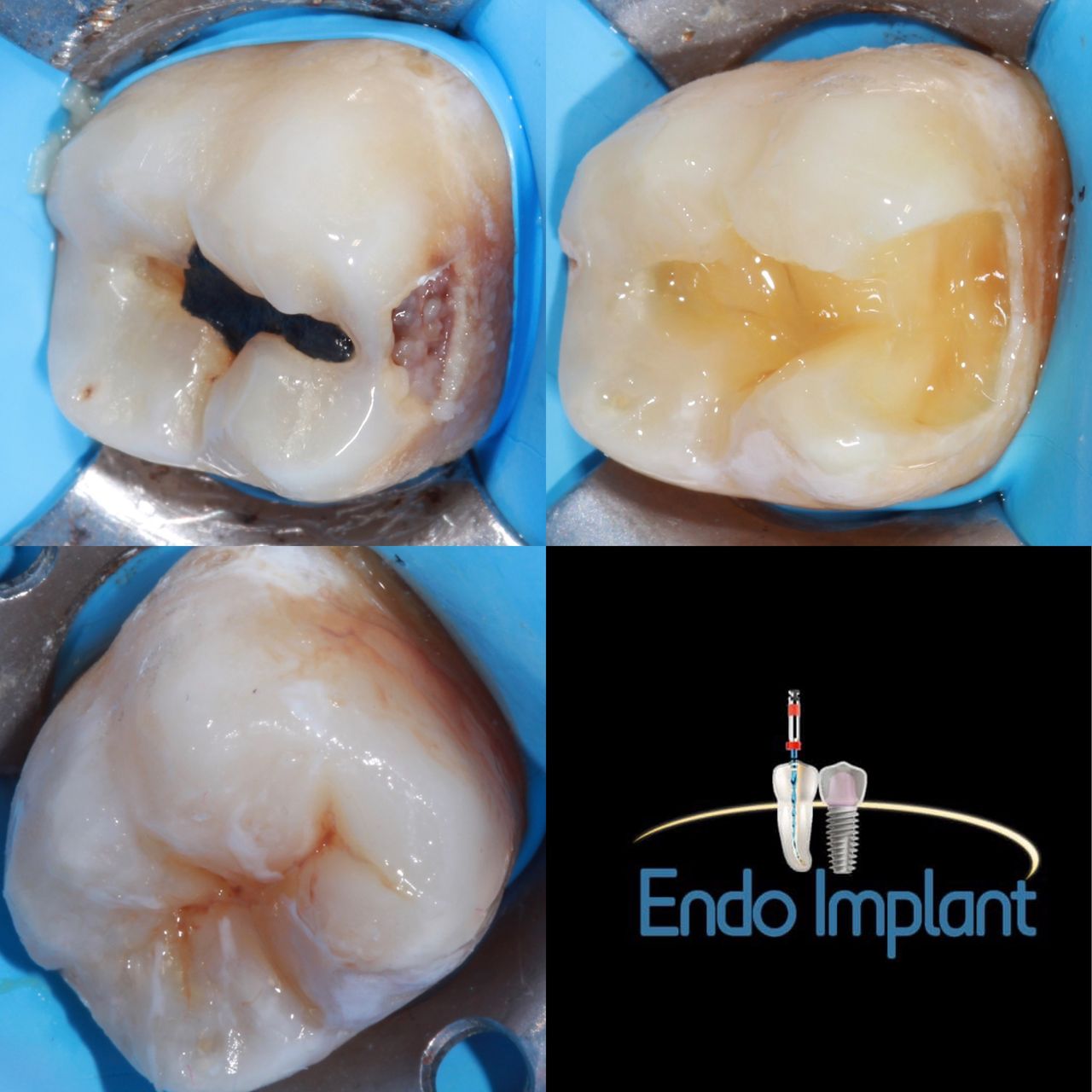 Jesus De La Cruz Ballinas-9