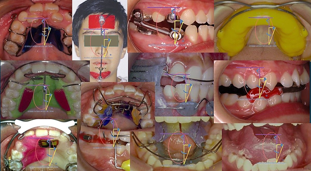 César Augusto Pérez Córdova-47