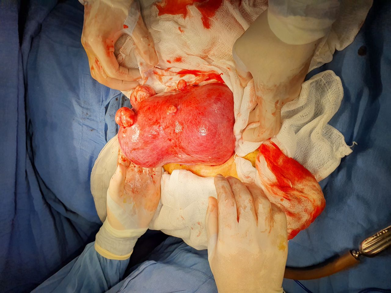 José Miguel Arano Acua-11