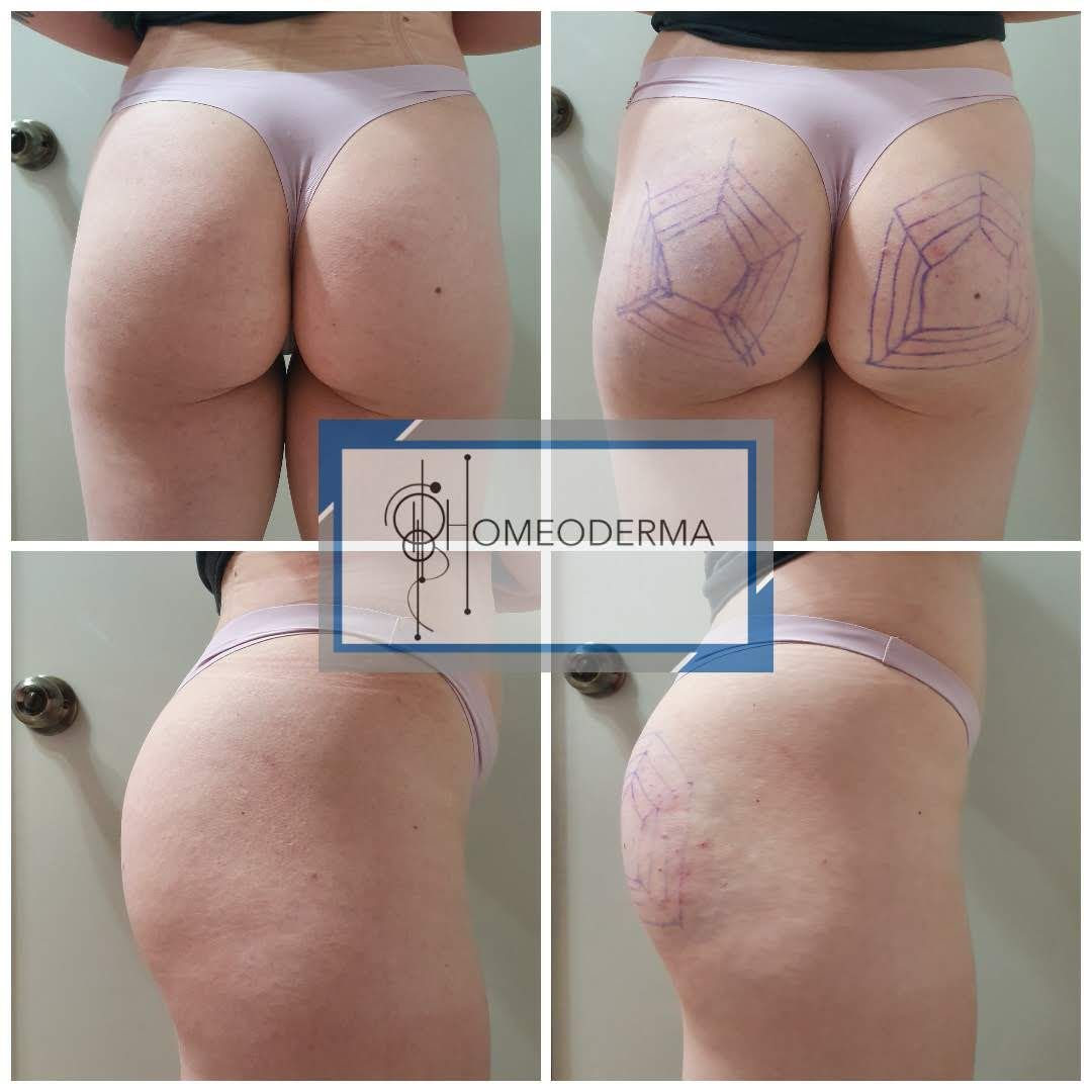 Gilliar Emmanuel Eudave De Lima-3