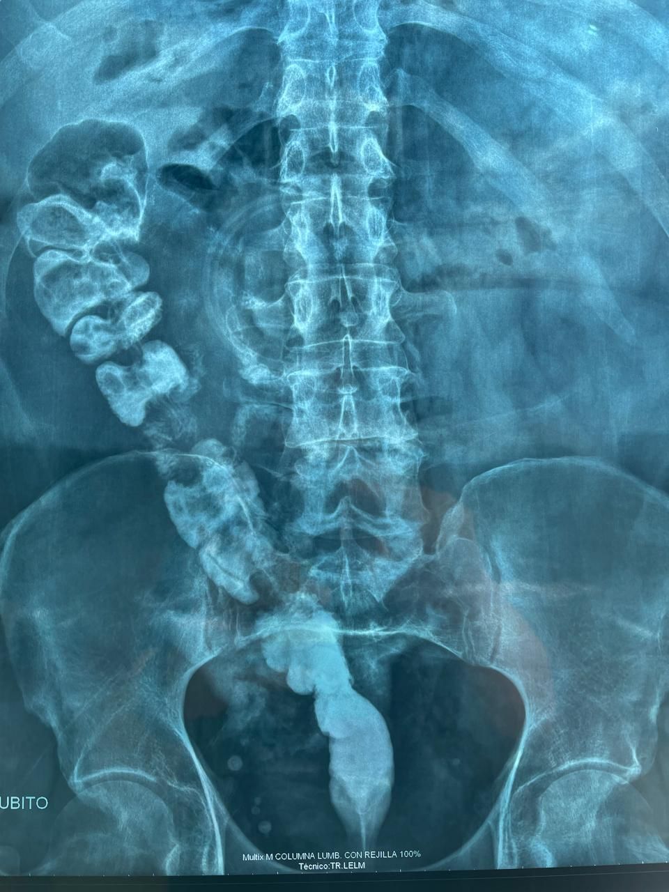 Noel Salgado Nesme-4