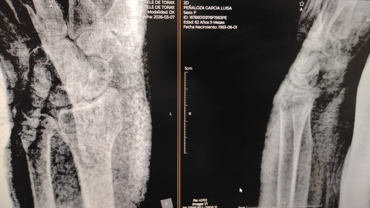 Alejandro Irisson-21