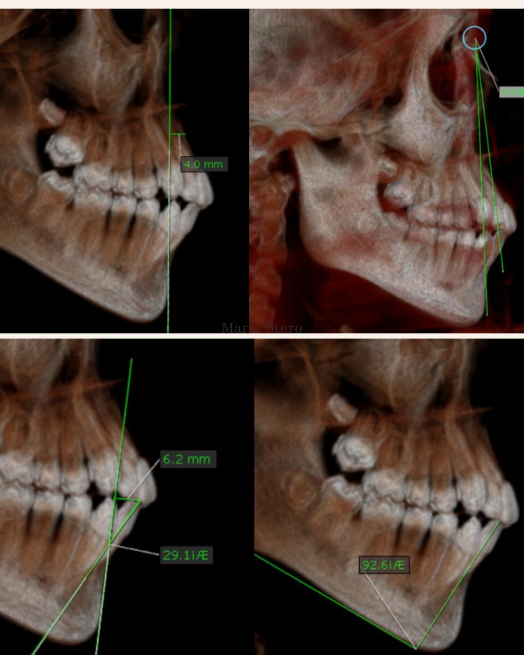 Maria Jesus Otero Lois-7