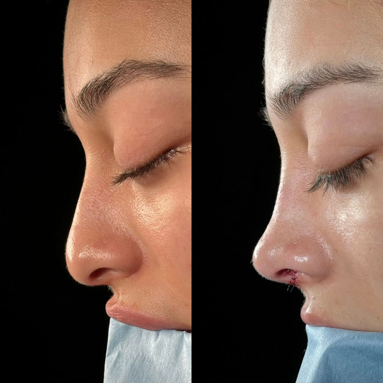 Angel Castro Urquizo-146