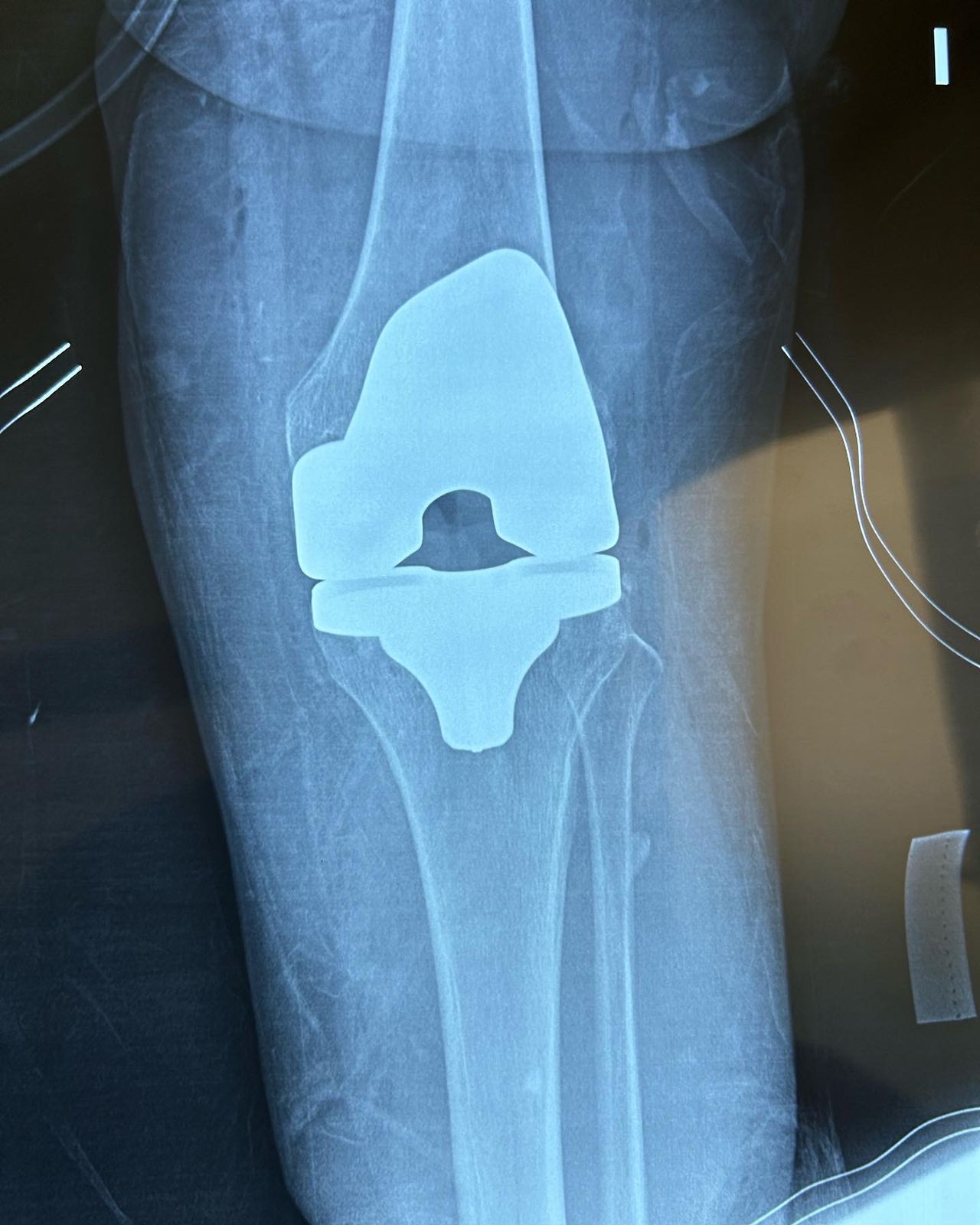 Giovanny Santander Becerra-36