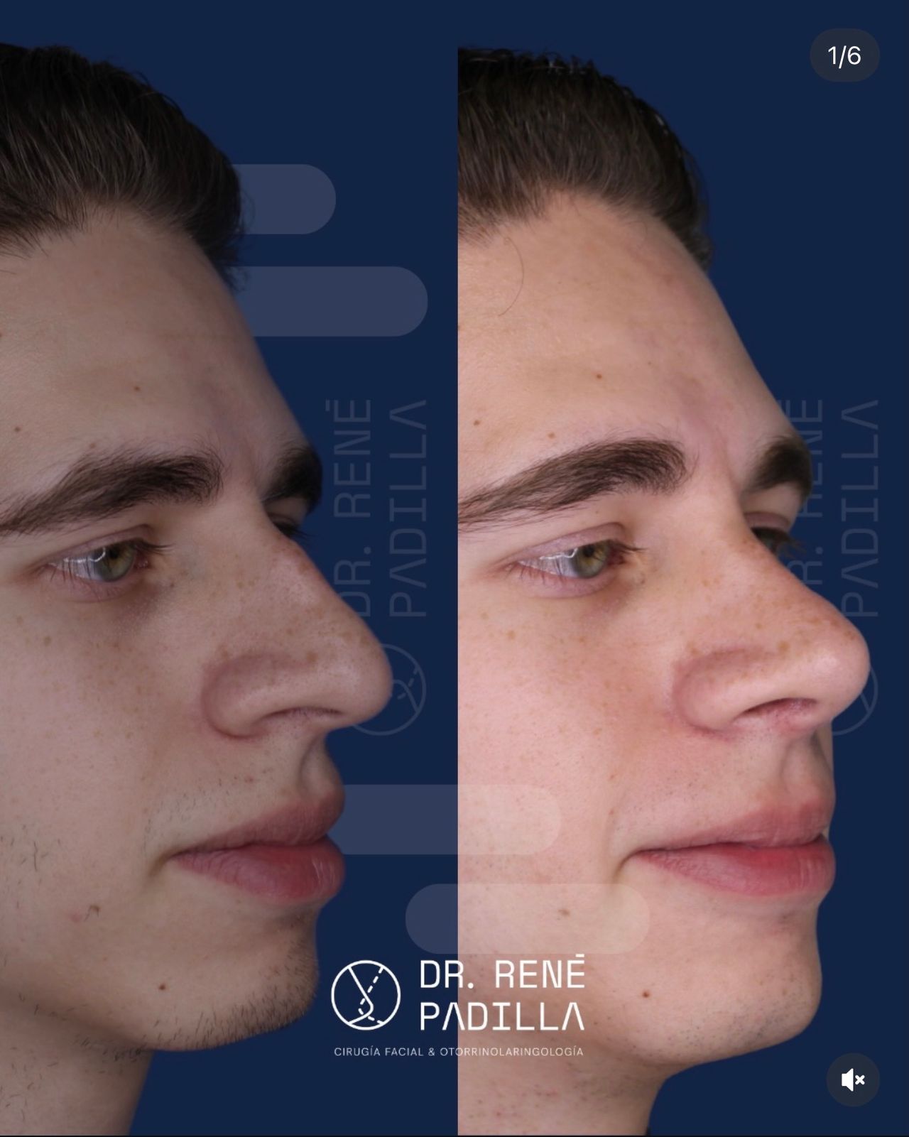 René Emmanuel Padilla López-8