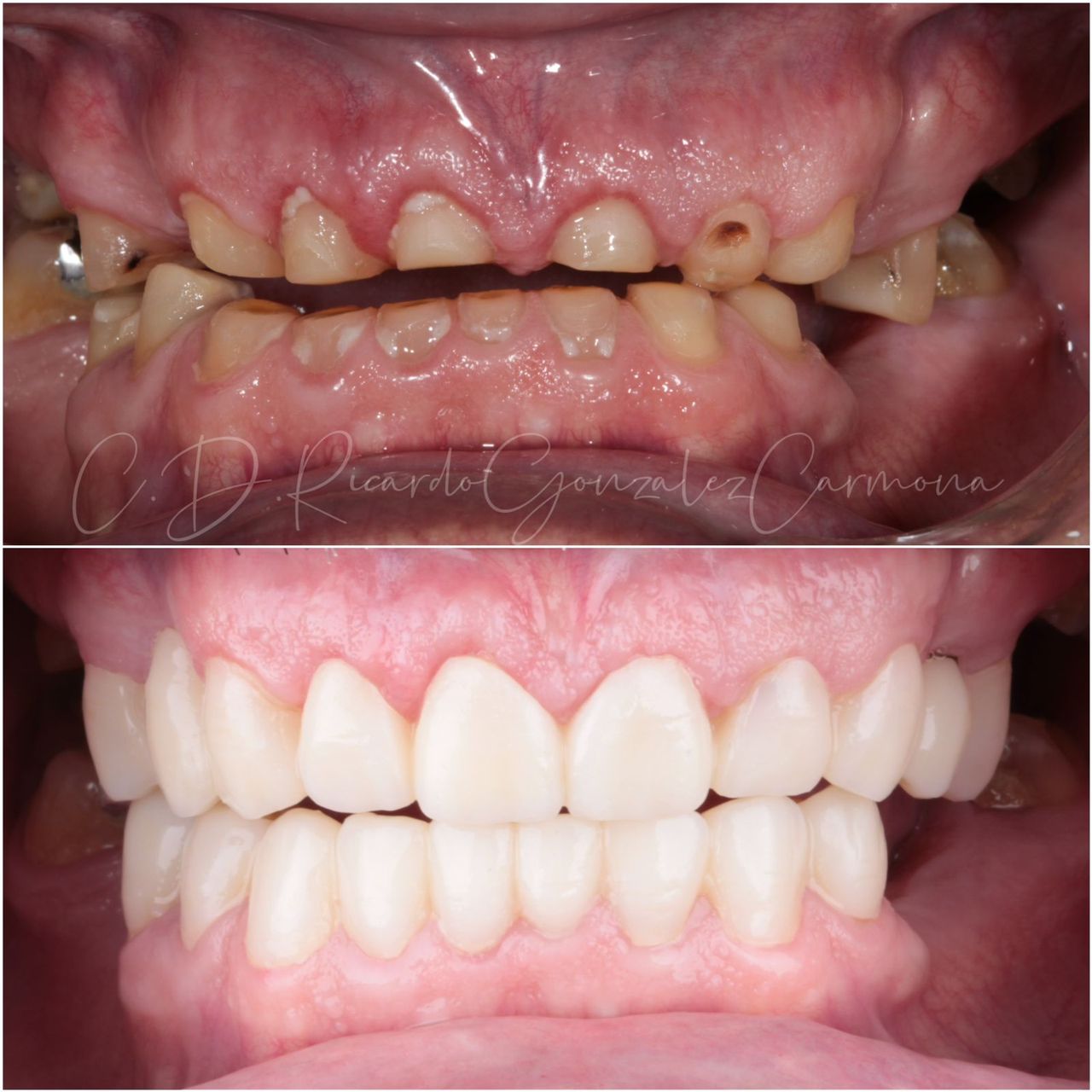 Ricardo González Carmona-4