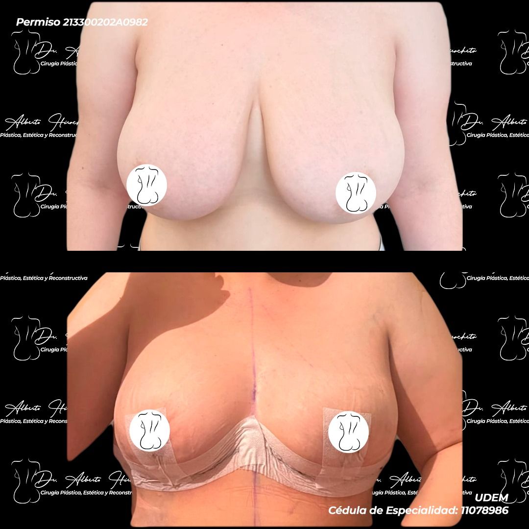 Alberto Hiracheta Torres-3