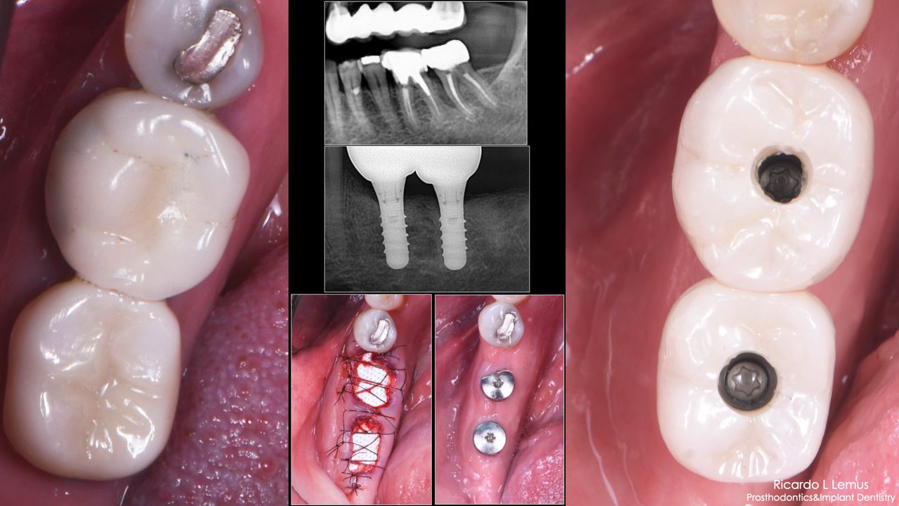 Ricardo López Lemus-111