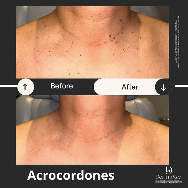 Karina Escobar Ramírez-6