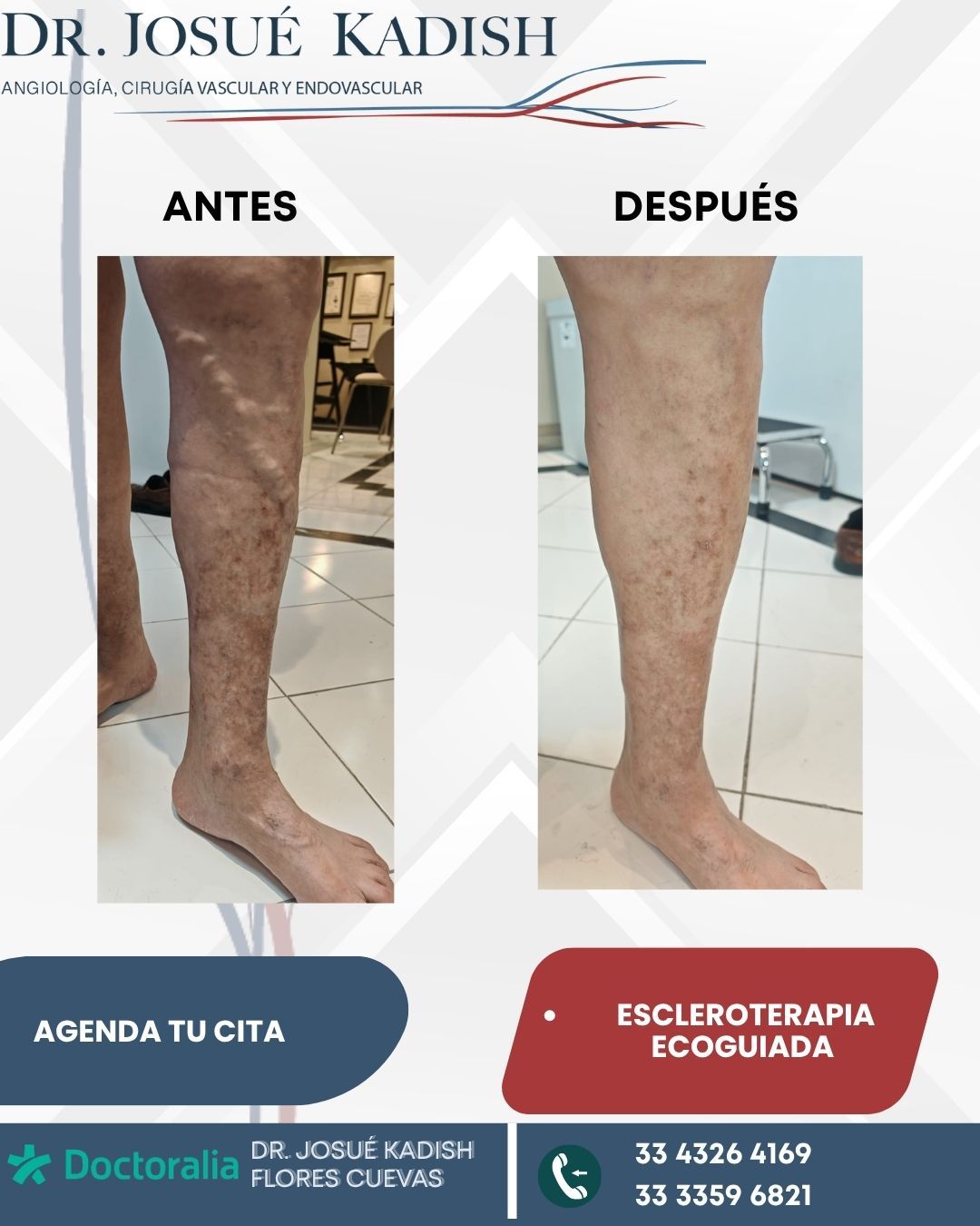 Josue Kadish Flores Cuevas-2