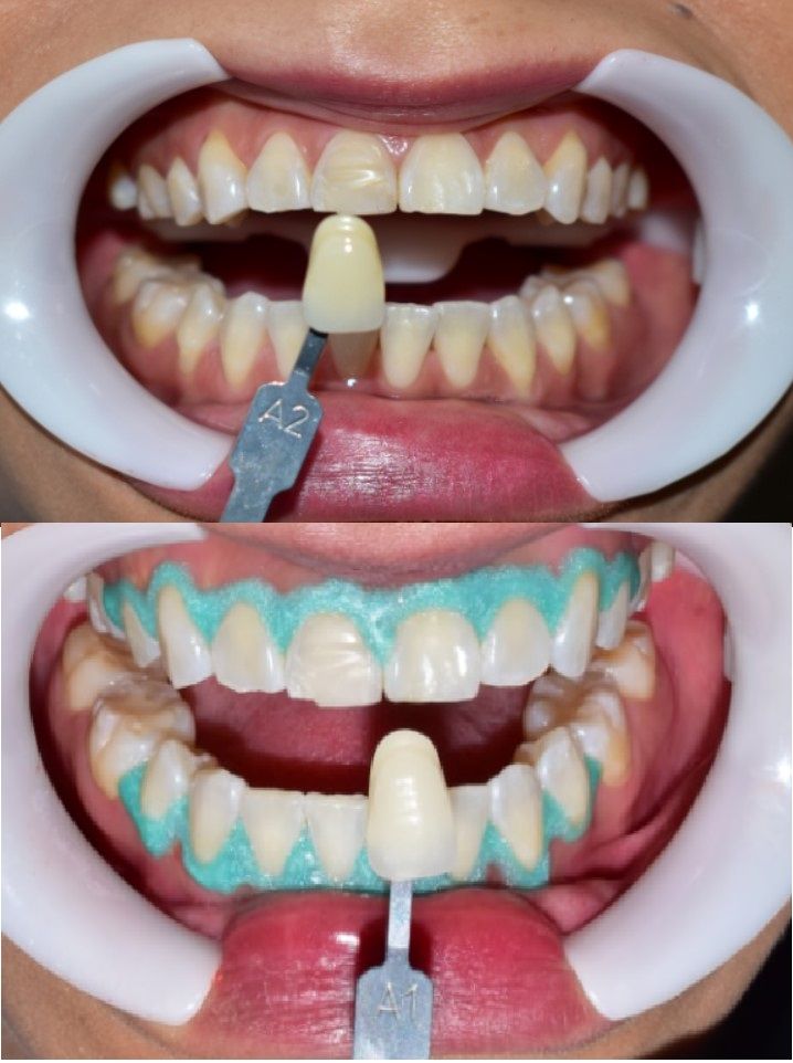 Arlen Colín Ordaz-29